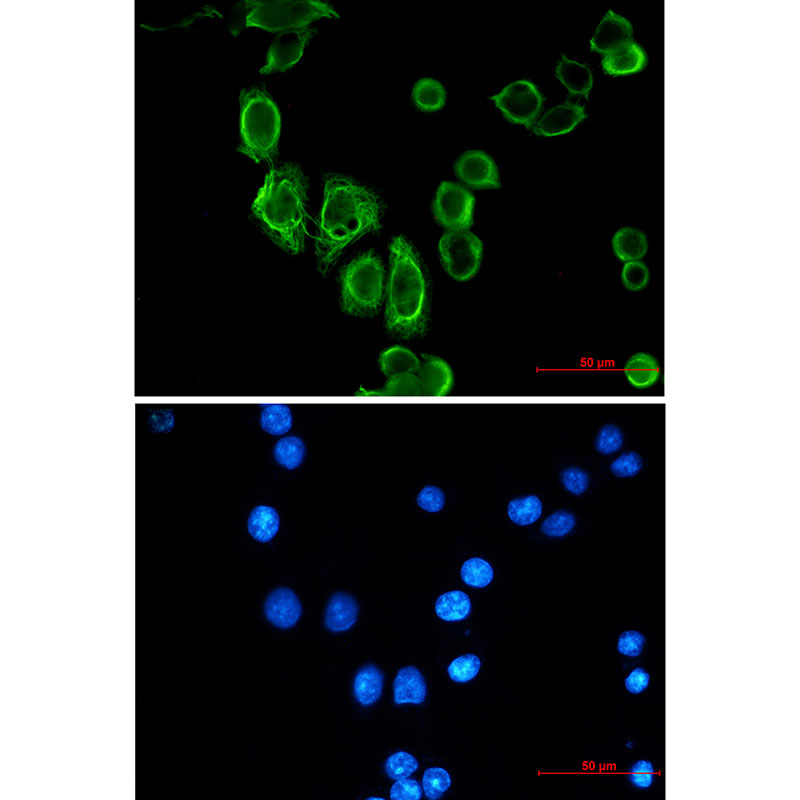 Cytokeratin 19 Rabbit mAb